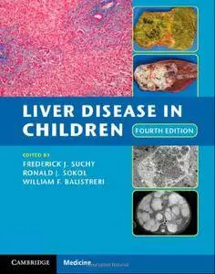 Liver Disease in Children (4th Edition)