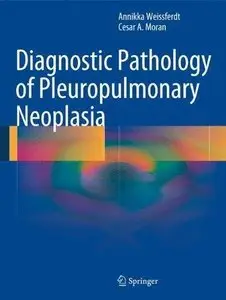 Diagnostic Pathology of Pleuropulmonary Neoplasia (Repost)
