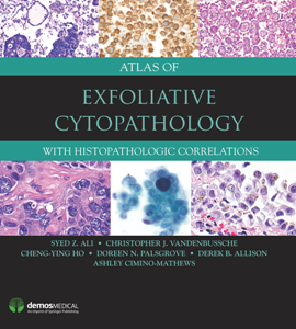 Atlas of Exfoliative Cytopathology : With Histopathologic Correlations