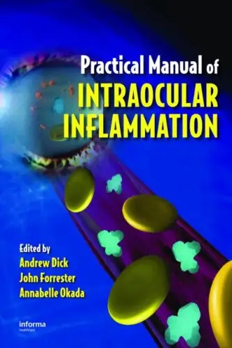 Practical Manual of Intraocular Inflammation (Repost)