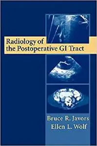 Radiology of the Postoperative GI Tract [Repost]