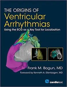 The Origins of Ventricular Arrythmias: Using the ECG as a Key Tool for Localization