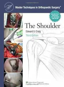 Master Techniques in Orthopaedic Surgery: The Shoulder, 3rd  Edition