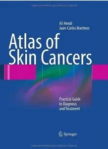 Atlas of Skin Cancers: Practical Guide to Diagnosis and Treatment