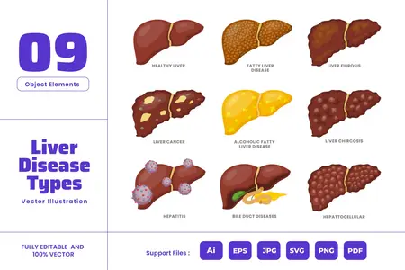 EE - Liver Disease  Internal Human Body Organ Cancer L59877C