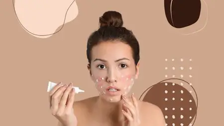 How To Treat Acne? - Everything You Need To Know