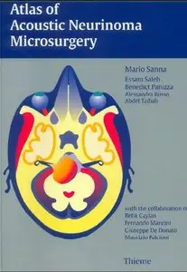 Atlas of Acoustic Neurinoma Microsurgery by M. Sanna [Repost]