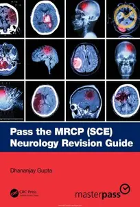 Pass the MRCP (SCE) Neurology Revision Guide