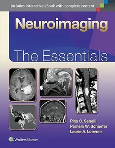 Neuroimaging: The Essentials (Repost)