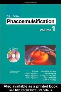 Phacoemulsification