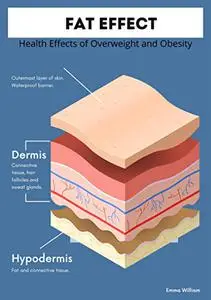 Fat Effect: Health Effects of Overweight and Obesity