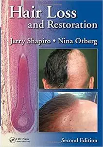 Hair Loss and Restoration