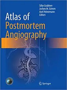 Atlas of Postmortem Angiography (Repost)