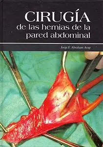 Cirugia de Las Hernias de La Pared Abdominal