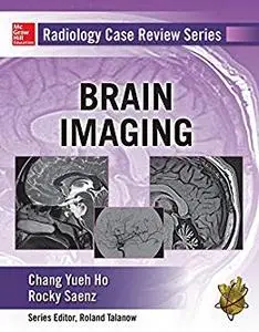 Radiology Case Review Series: Brain Imaging