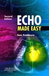 Echo Made Easy, 2e (repost)