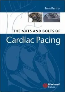 The Nuts and Bolts of Cardiac Pacing, 2nd Edition (Repost)