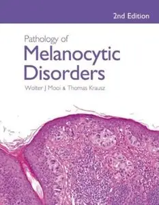 Pathology of Melanocytic Disorders, 2nd edition