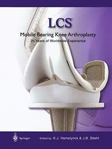LCS® Mobile Bearing Knee Arthroplasty: A 25 Years Worldwide Review