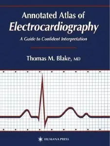 Annotated Atlas of Electrocardiography: A Guide to Confident Interpretation (Repost)