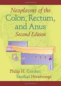 Neoplasms of the Colon, Rectum, and Anus,