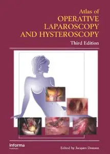 Atlas of Operative Laparoscopy and Hysteroscopy, Third Edition by Jacques Donnez [Repost]