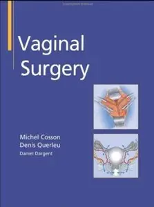 Vaginal Surgery