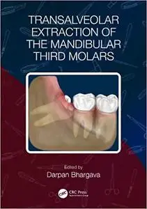 Transalveolar Extraction of the Mandibular Third Molars