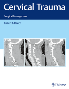 Cervical Trauma : Surgical Management