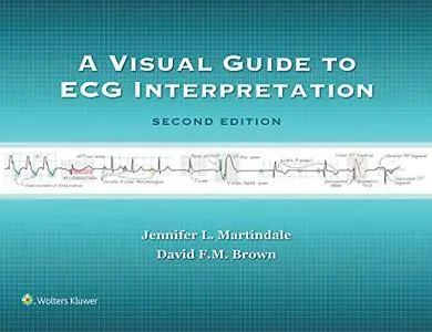 A Visual Guide to ECG Interpretation 2nd Edition (repost)