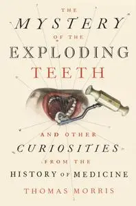 The Mystery of the Exploding Teeth: And Other Curiosities from the History of Medicine