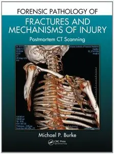 Forensic Pathology of Fractures and Mechanisms of Injury: Postmortem CT Scanning