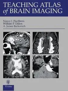 Teaching Atlas of Brain Imaging (repost)