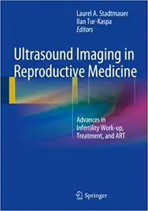 Ultrasound Imaging in Reproductive Medicine: Advances in Infertility Work-up, Treatment, and ART (Repost)