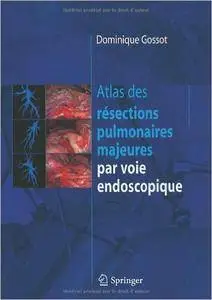 Atlas des résections pulmonaires majeures par voie endoscopique