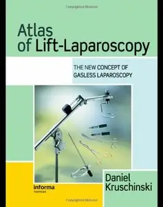 Atlas of Lift-Laparoscopy by Daniel Kruschinski