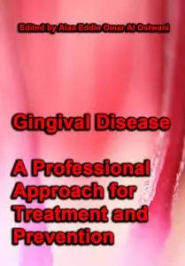 "Gingival Disease: A Professional Approach for Treatment and Prevention" ed. by Alaa Eddin Omar Al Ostwani