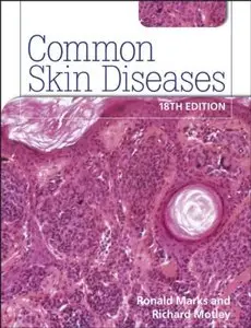 Common Skin Diseases (18th edition) (Repost)