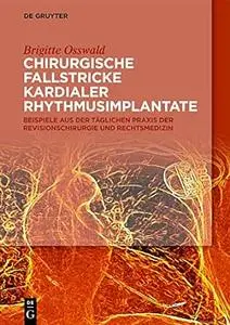 Chirurgische Fallstricke kardialer Rhythmusimplantate