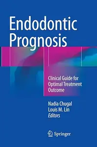 Endodontic Prognosis: Clinical Guide for Optimal Treatment Outcome (Repost)