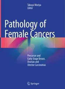 Pathology of Female Cancers: Precursor and Early-Stage Breast, Ovarian and Uterine Carcinomas (Repost)