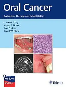 Oral Cancer: Evaluation, Therapy, and Rehabilitation