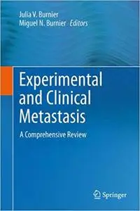 Experimental and Clinical Metastasis: A Comprehensive Review