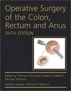 Operative Surgery of the Colon, Rectum and Anus (6th Edition)