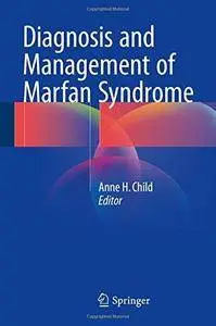 Diagnosis and Management of Marfan Syndrome (Repost)