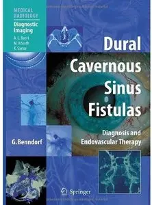 Dural Cavernous Sinus Fistulas: Diagnosis and Endovascular Therapy (repost)