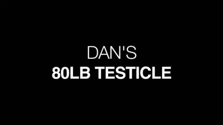 Dan's 80lb Testicle (2019)