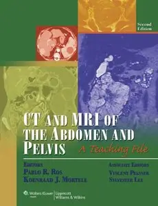 CT and MRI of the Abdomen and Pelvis: A Teaching File, (2nd Edition)