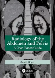 Radiology of the Abdomen and Pelvis: A Case-Based Guide