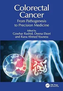 Colorectal Cancer: From Pathogenesis to Precision Medicine
